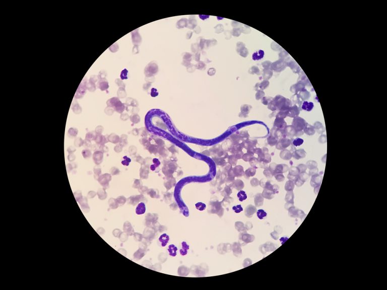 Imagem de células com Dirofilariose, tirada de um microscópio.